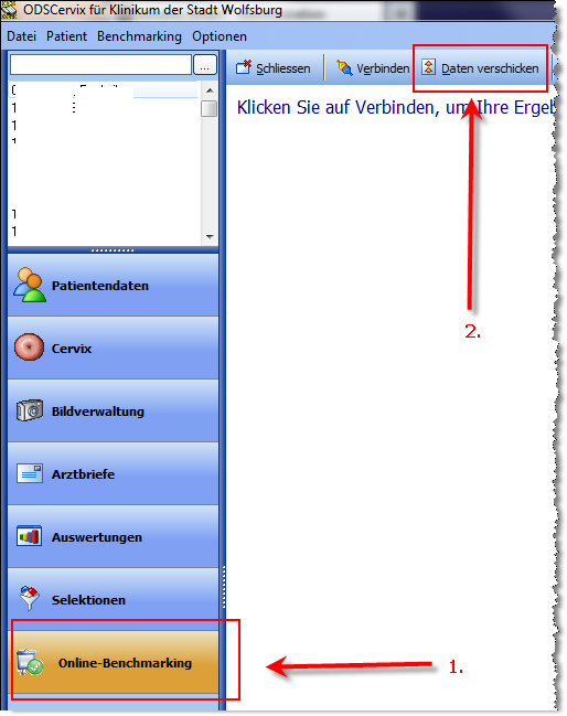 ODSdysplasie Daten versenden